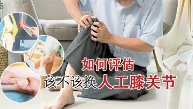 Photo of 【关节保养学】如何评估该不该换人工膝关节