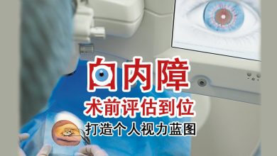 Photo of 【重塑好视力专题（4）】白内障术前评估到位 打造个人视力蓝图