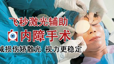 Photo of 【重塑好视力专题（3）】飞秒激光辅助白内障手术 减损伤矫散光 视力更稳定